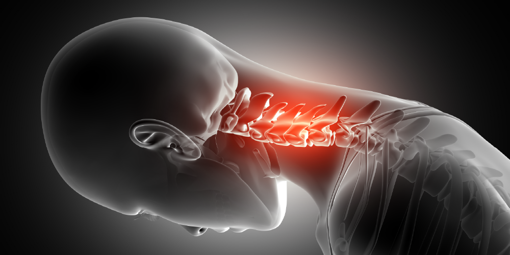 Pinched Nerve Pain – Comprehensive Pain