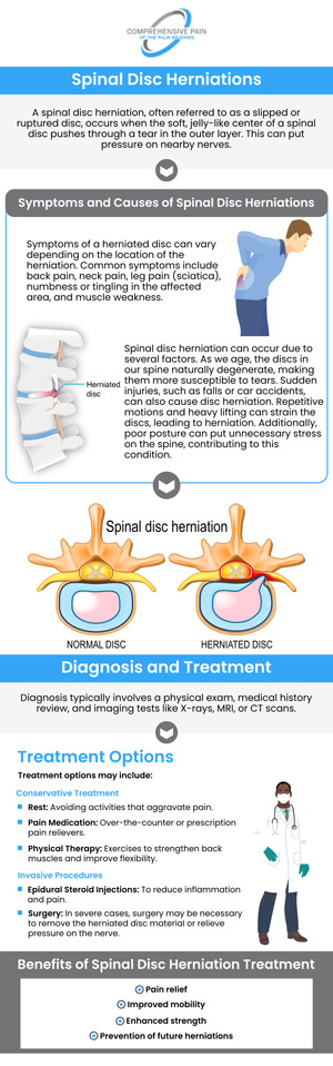A herniated disc occurs when the soft inner gel of a spinal disc pushes through a crack in its tougher exterior, often pressing on nearby nerves. This can lead to pain, numbness, or weakness, typically in the back, arms, or legs. At Comprehensive Pain of the Palm Beaches, our team offers treatment for herniated discs, providing relief and restoring function. For more information, contact us or book an appointment online. Our clinics are conveniently located in Greenacres, FL, and Port St. Lucie, FL.